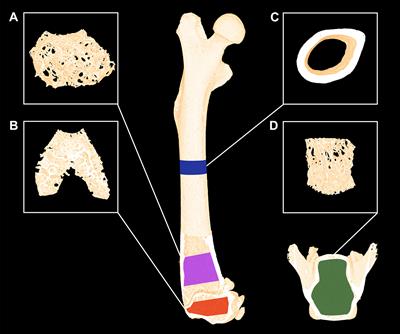 Teriparatide and Abaloparatide Have a Similar Effect on Bone in Mice